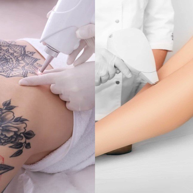 Combo Non Invasive Laser Hair & Tattoo Removal – Angel Spa & Academy